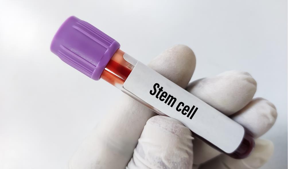 Stem cell therapy specialists Mexico 